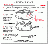 Surgeons Knot.gif